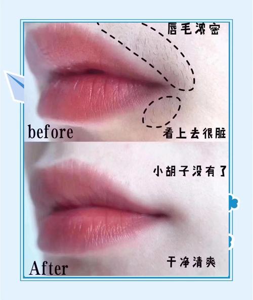 女孩为什么会长胡子