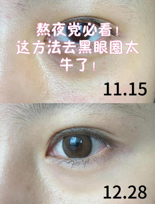 用洗面奶怎么消掉黑眼圈