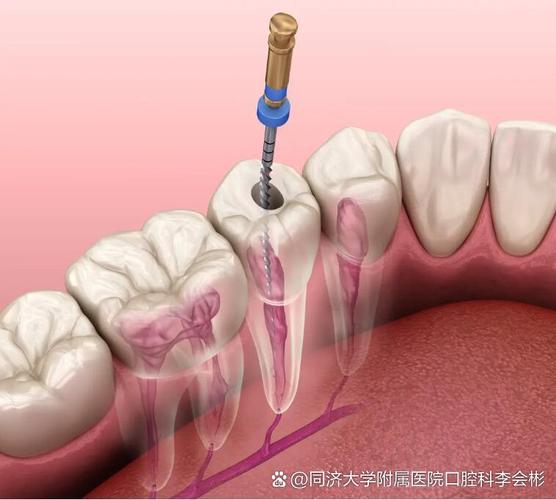 为什么看牙那么贵