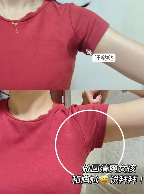腋下出汗挂什么科