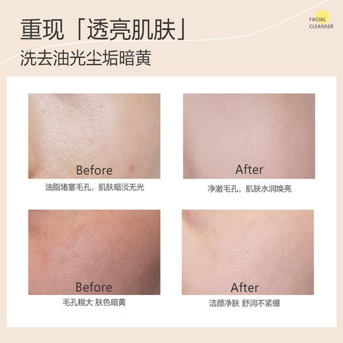 有情蒲公英祛斑洗面奶怎么样