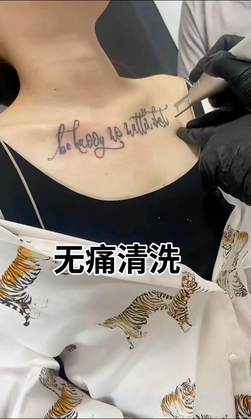 什么医院可以洗纹身