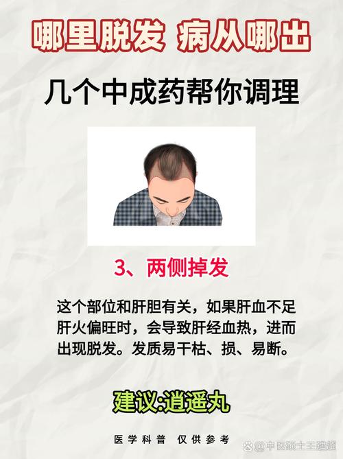 头顶脱发吃什么好