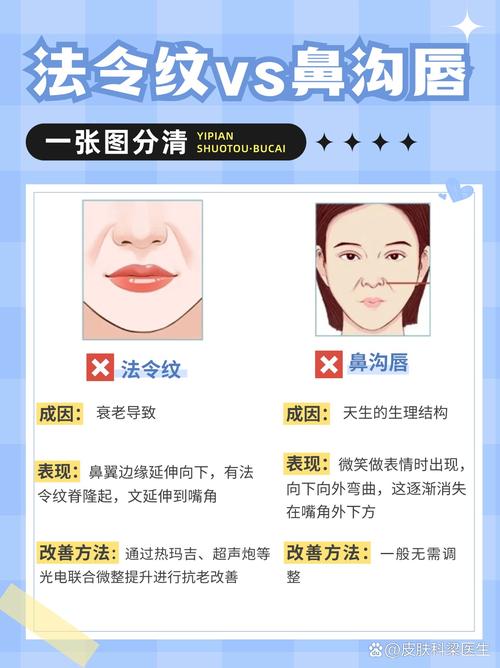 什么是鼻沟唇