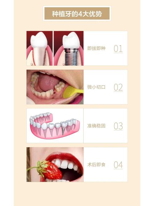 种植牙有什么要求