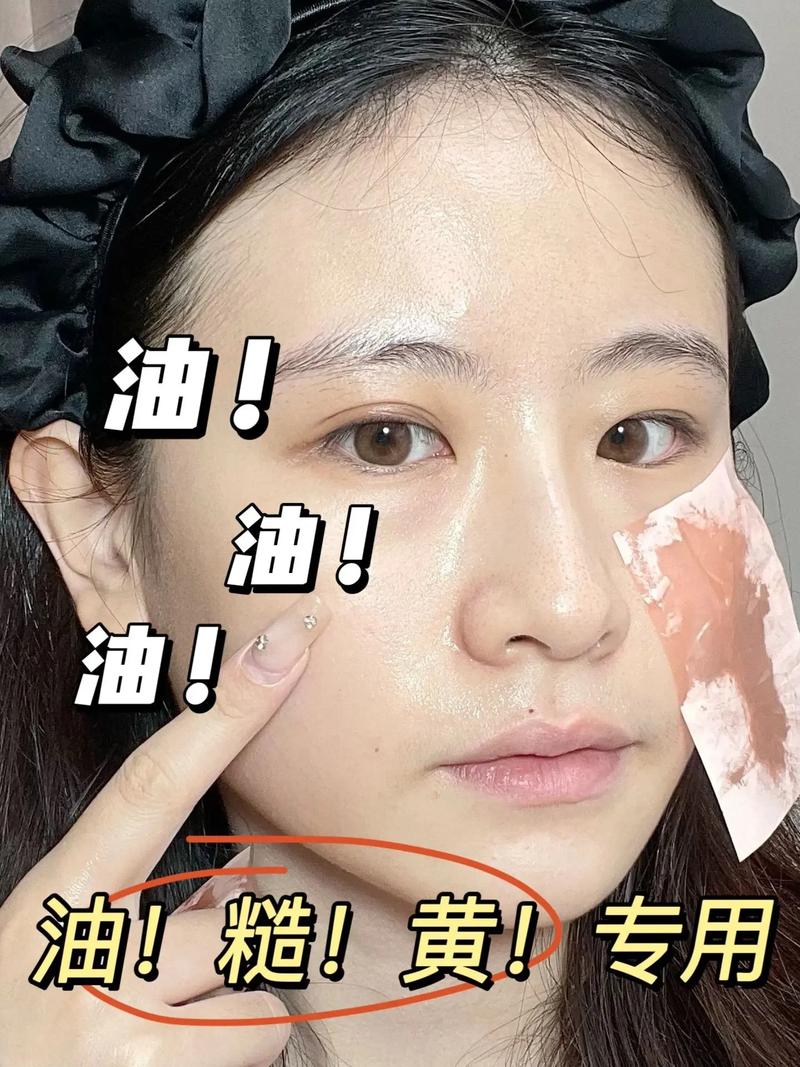脸上出油是什么皮肤