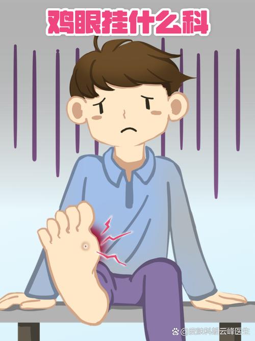 鸡眼看什么科室