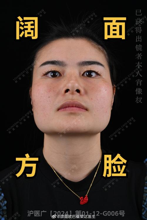 什么是国子脸