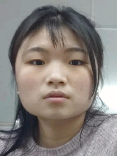 什么是国子脸