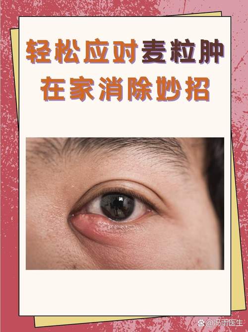 眼睛肿什么病