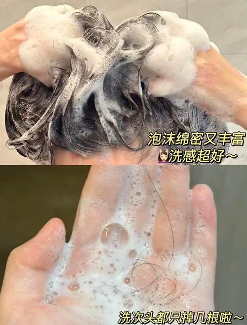 什么防掉发