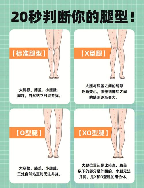 正常的腿型是什么样的