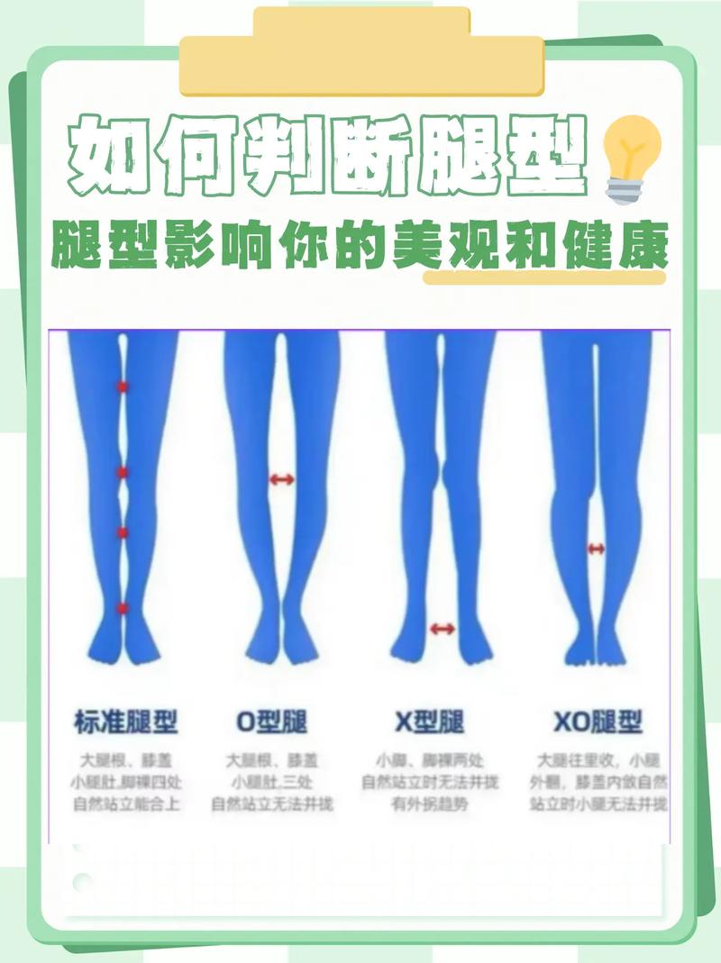 正常的腿型是什么样的
