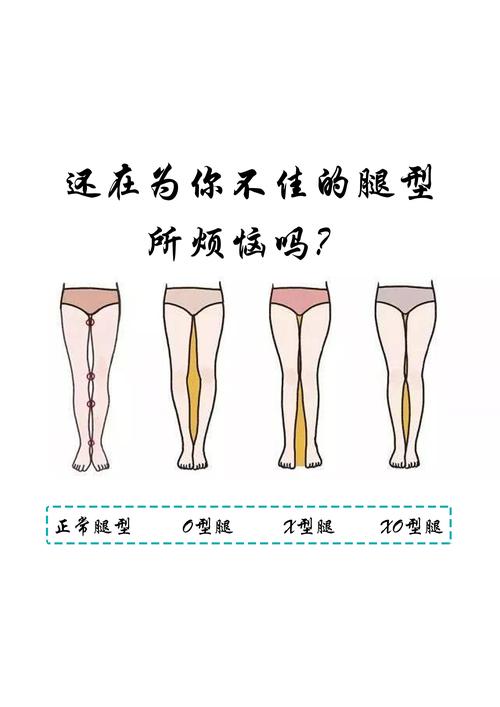 正常的腿型是什么样的