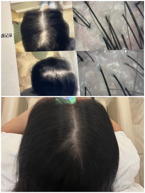 头发的毛囊是什么样的
