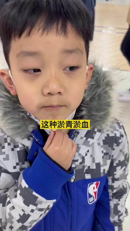 为什么小孩有黑眼圈