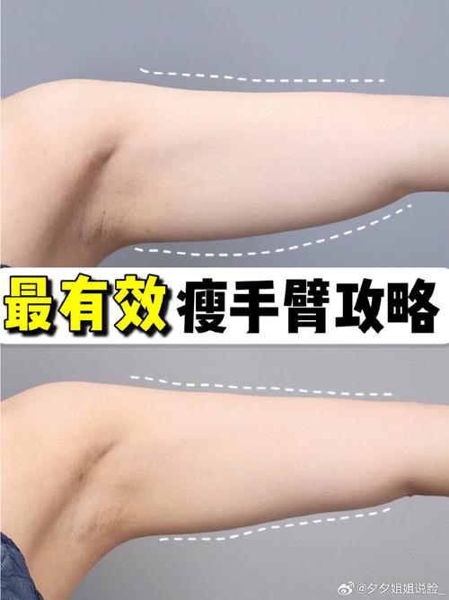 手臂为什么越来越粗