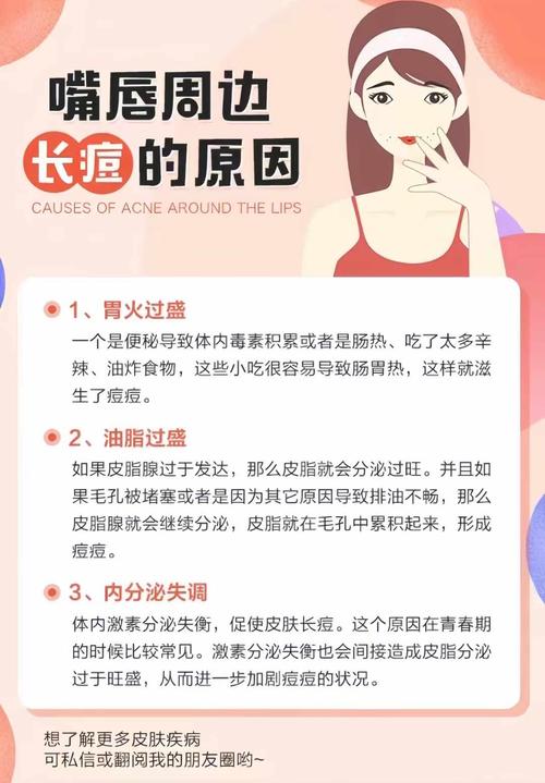 嘴边起痘痘什么原因