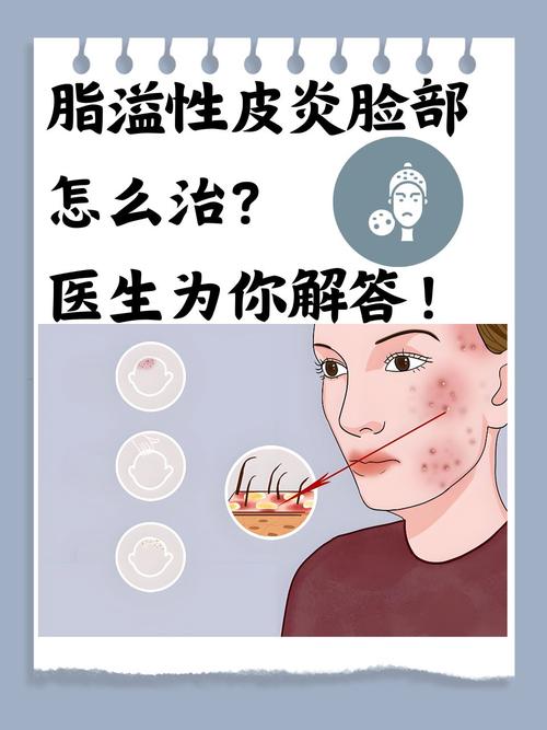 脸油腻是什么原因
