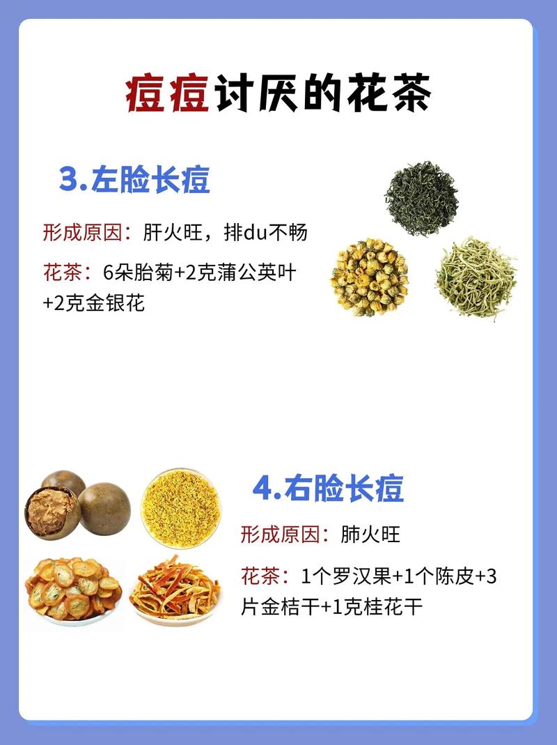 喝什么水可以祛痘