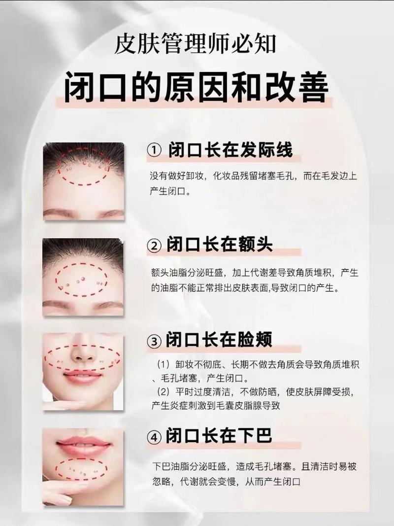 脸上为什么粉刺