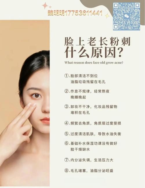 脸上为什么粉刺