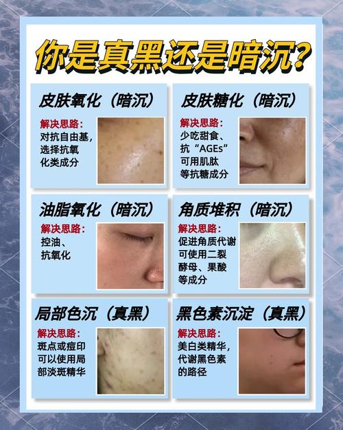 暗沉是什么