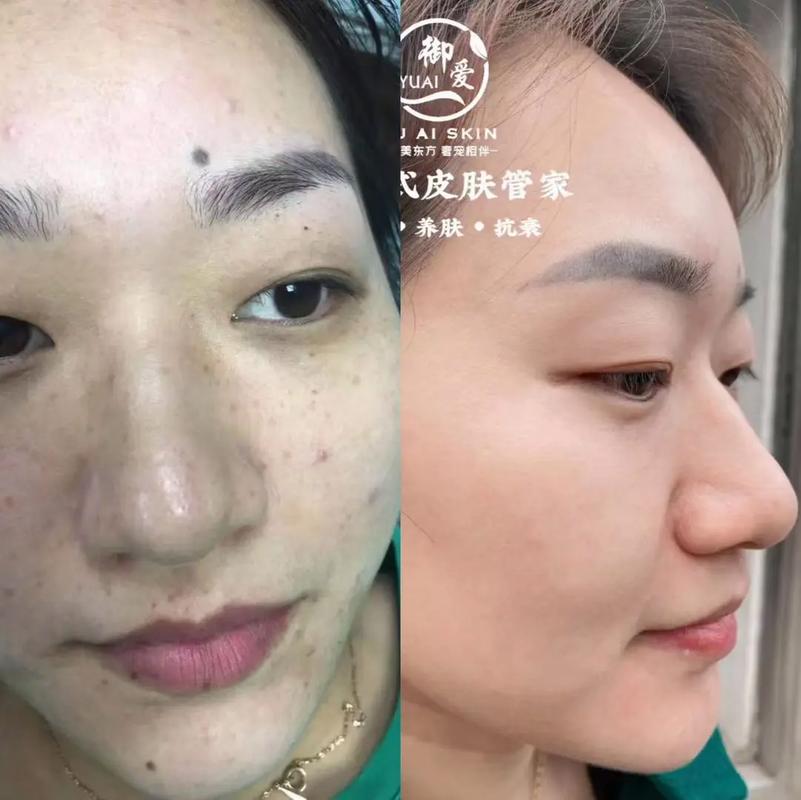 什么是干斑