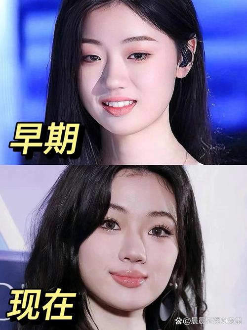 为什么脸宽