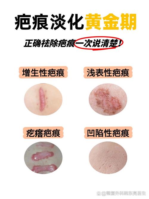 什么修复疤痕最好