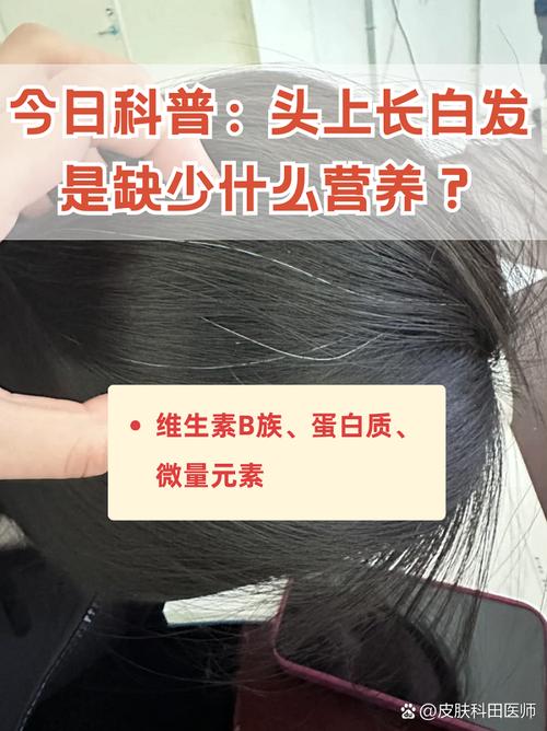 头发缺少什么