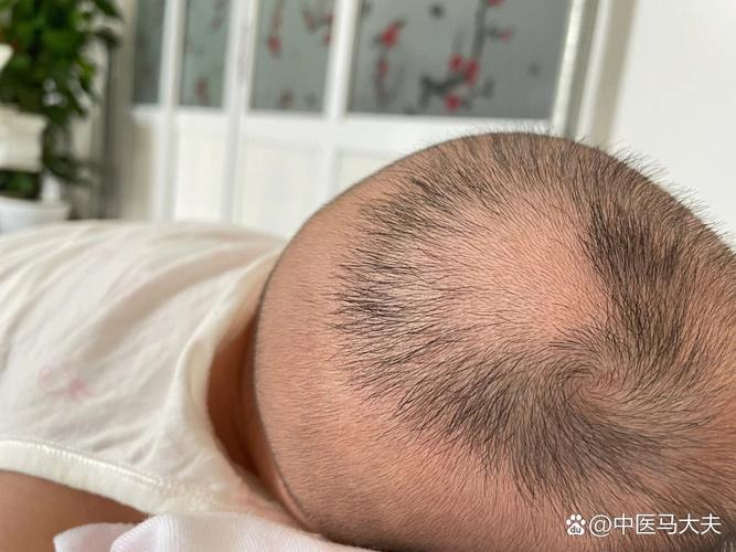 头发缺少什么