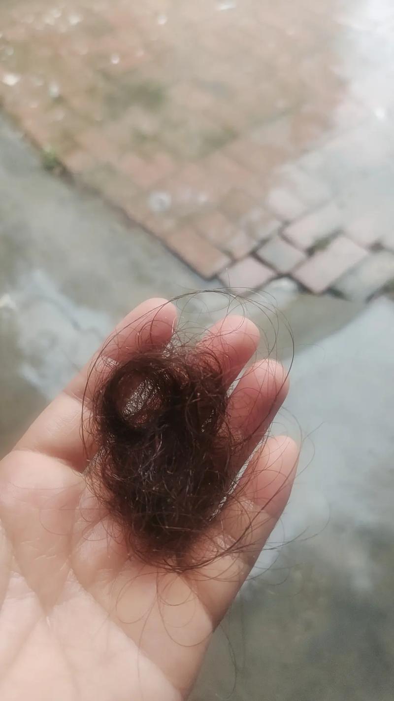 为什么掉那么多头发