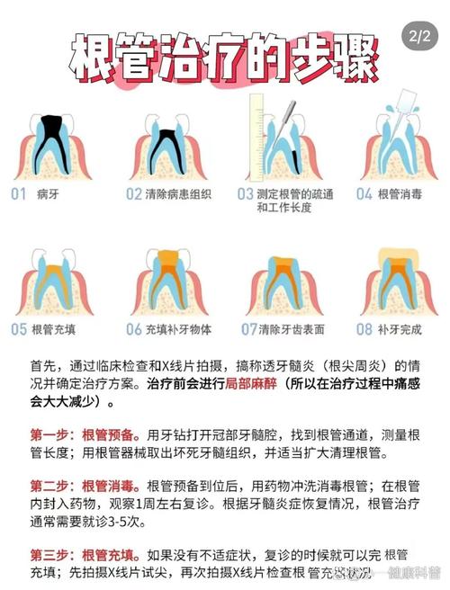 什么情况做根管治疗