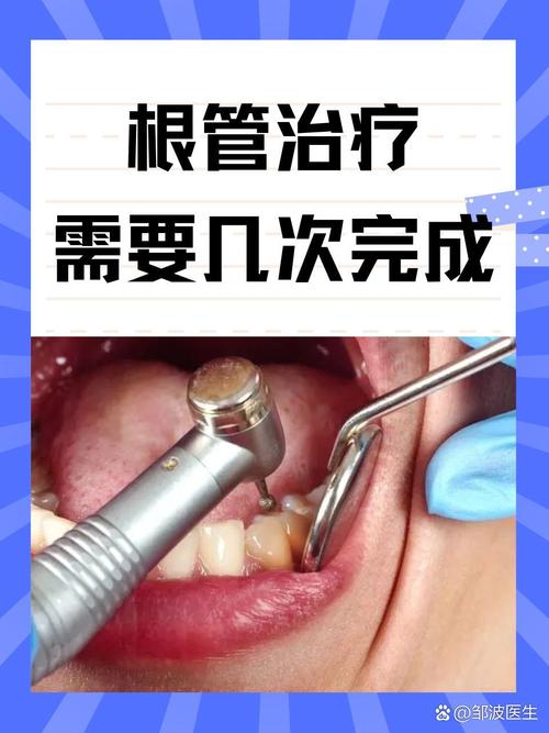 什么情况做根管治疗