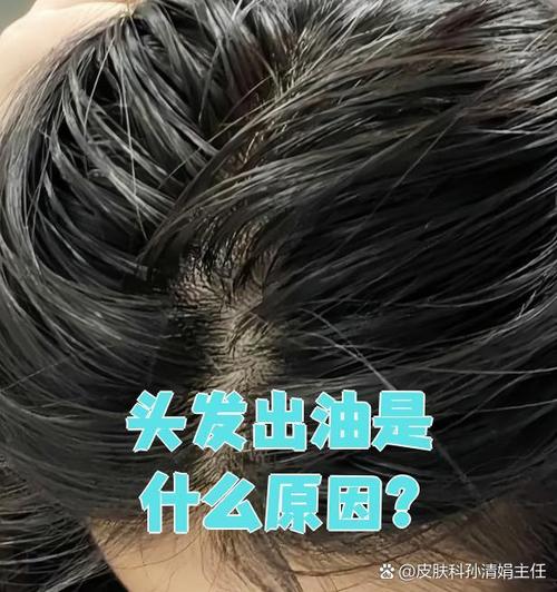 头发为什么会变油