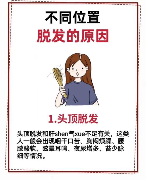 额头脱发是什么原因