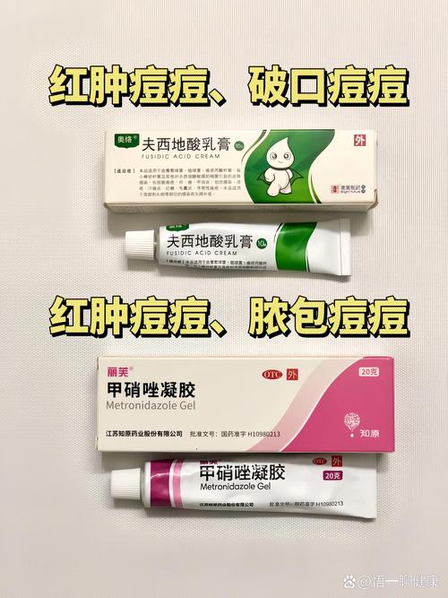 祛痘什么药膏最有效