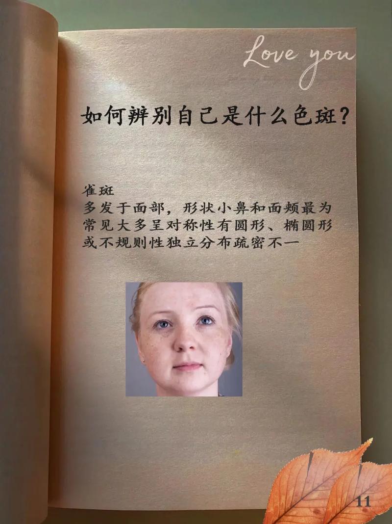 什么是蝴蝶斑