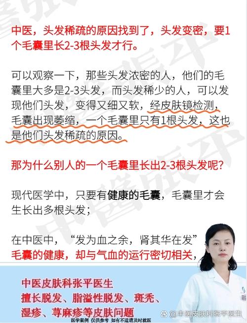 头发稀疏看什么科