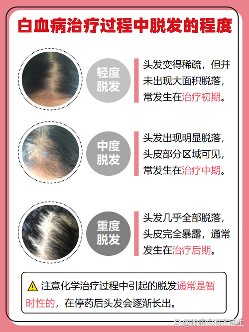 头发稀疏看什么科