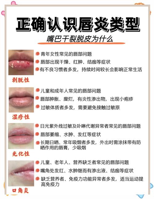 漂唇有什么危害