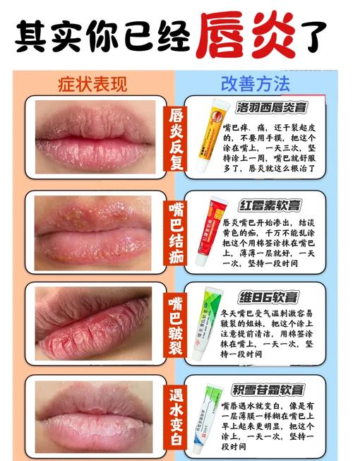 漂唇有什么危害