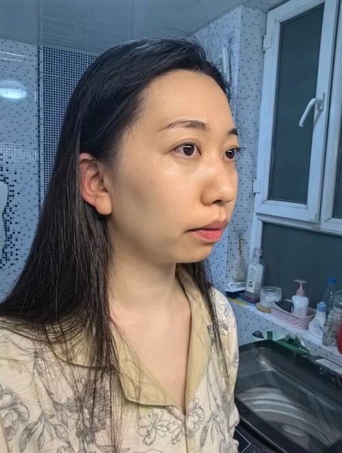 什么是下巴后缩