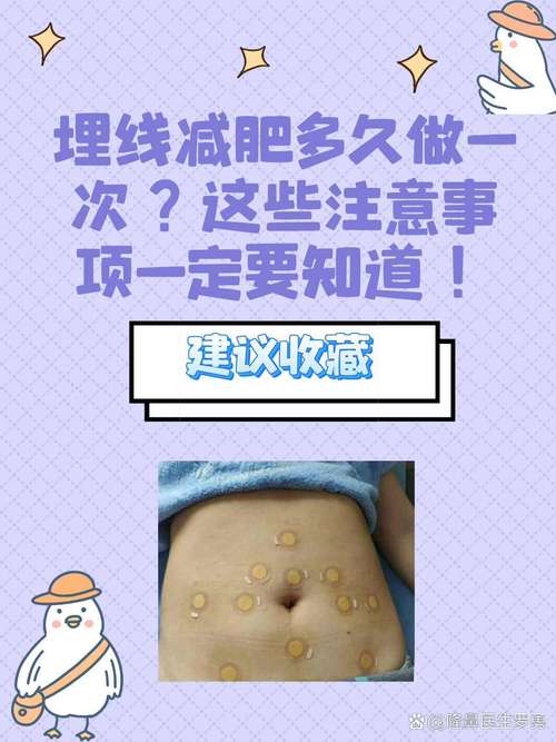 埋线减肥做完什么感觉