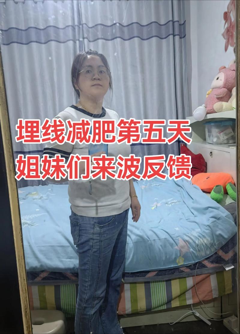 埋线减肥做完什么感觉