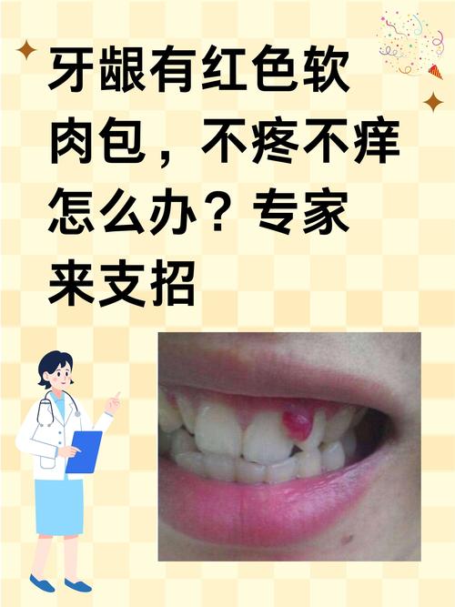 为什么牙龈老是肿痛