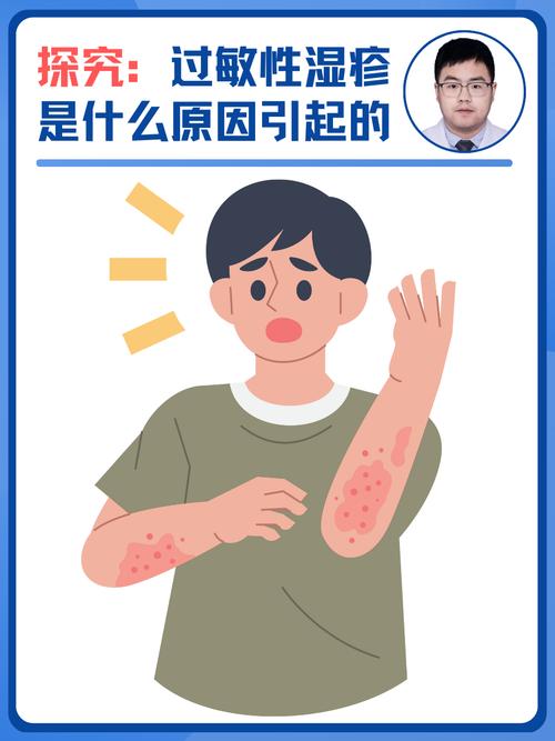 什么病会痒