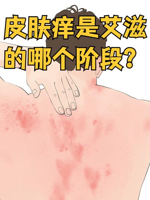 什么病会痒
