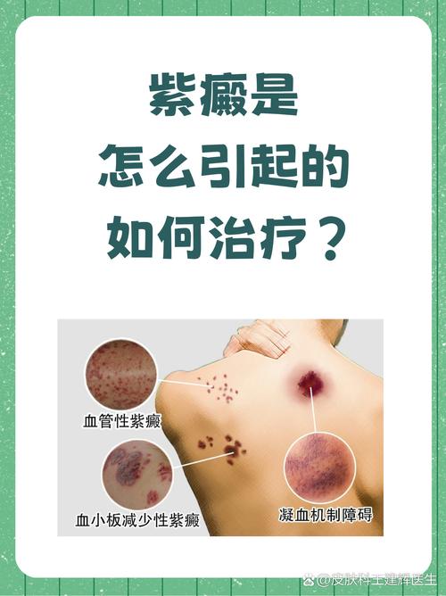 什么是血疹